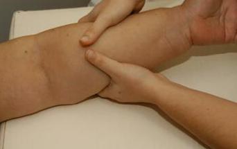 Linfatico Brazo Masaje Linfedema Drenaje Linfático Masajes De